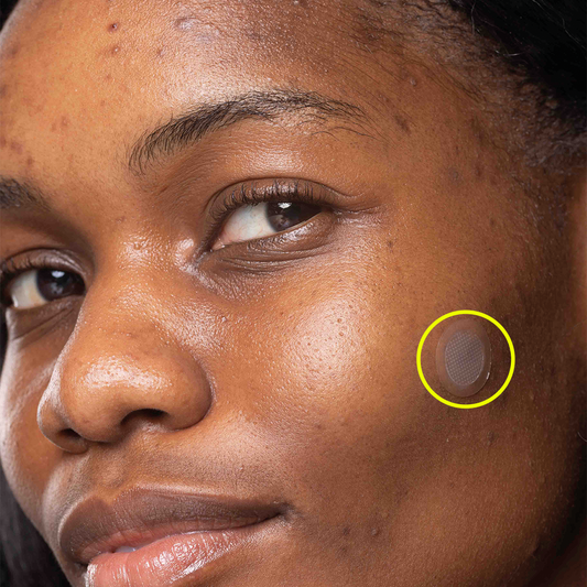 Who Are Or What Is The Superdots. ?