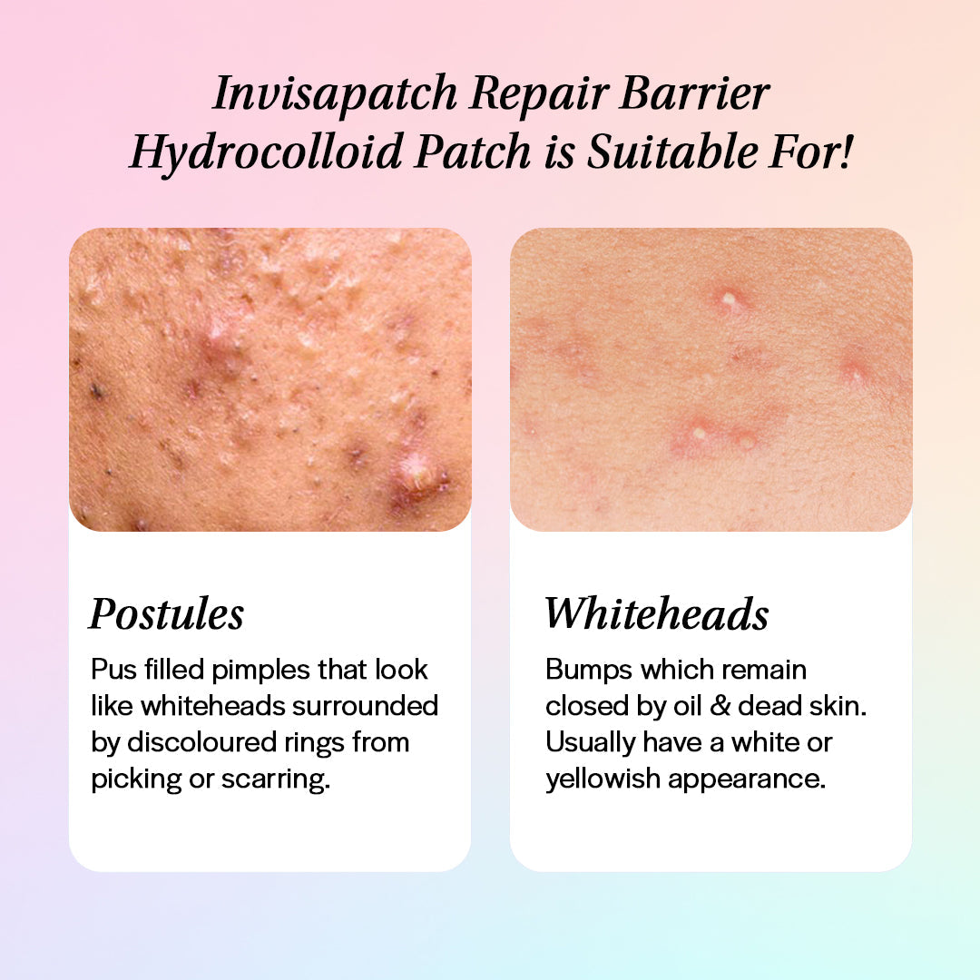 Invisapatch before and after