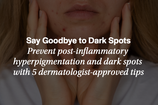 5 Ways to Avoid Hyperpigmentation