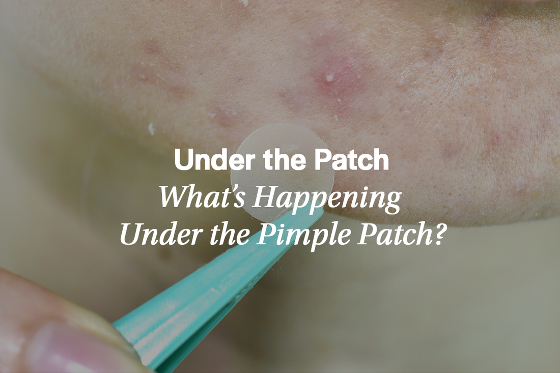 What’s Happening Under the Pimple Patch?