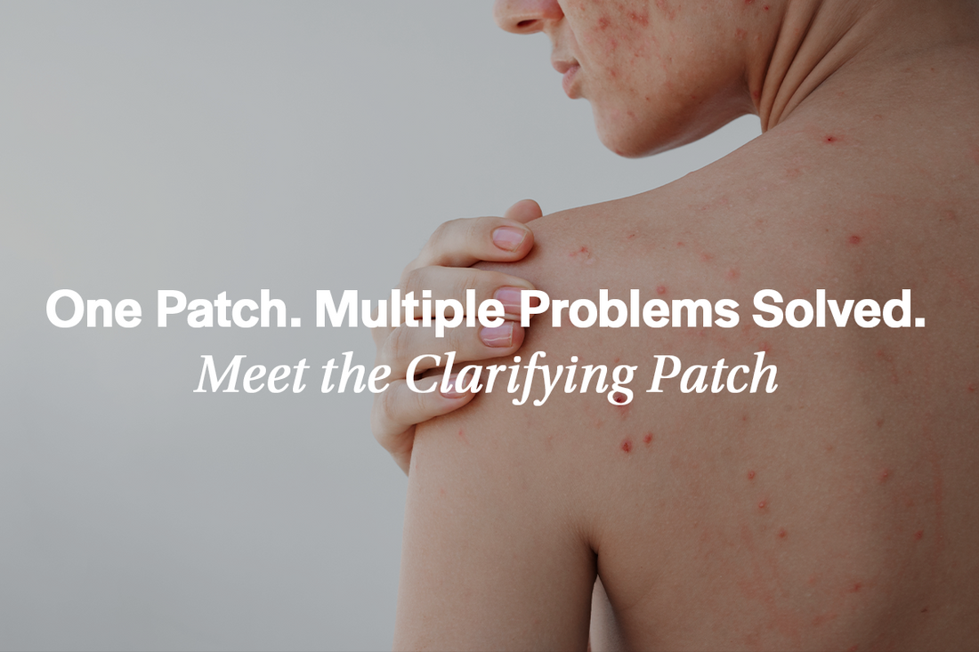 One Patch. Multiple Problems Solved: Meet the Clarifying Patch