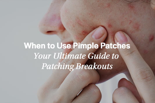 Not Every Bump Needs a Patch: When to Use a Pimple Patch (and When to Skip It)