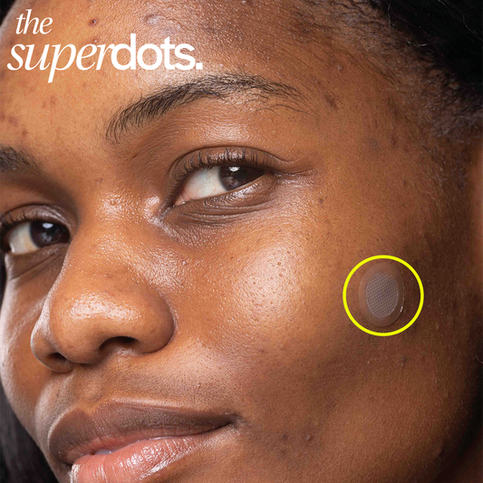 Pimple Patch vs Spot Treatment: Which is More Effective?