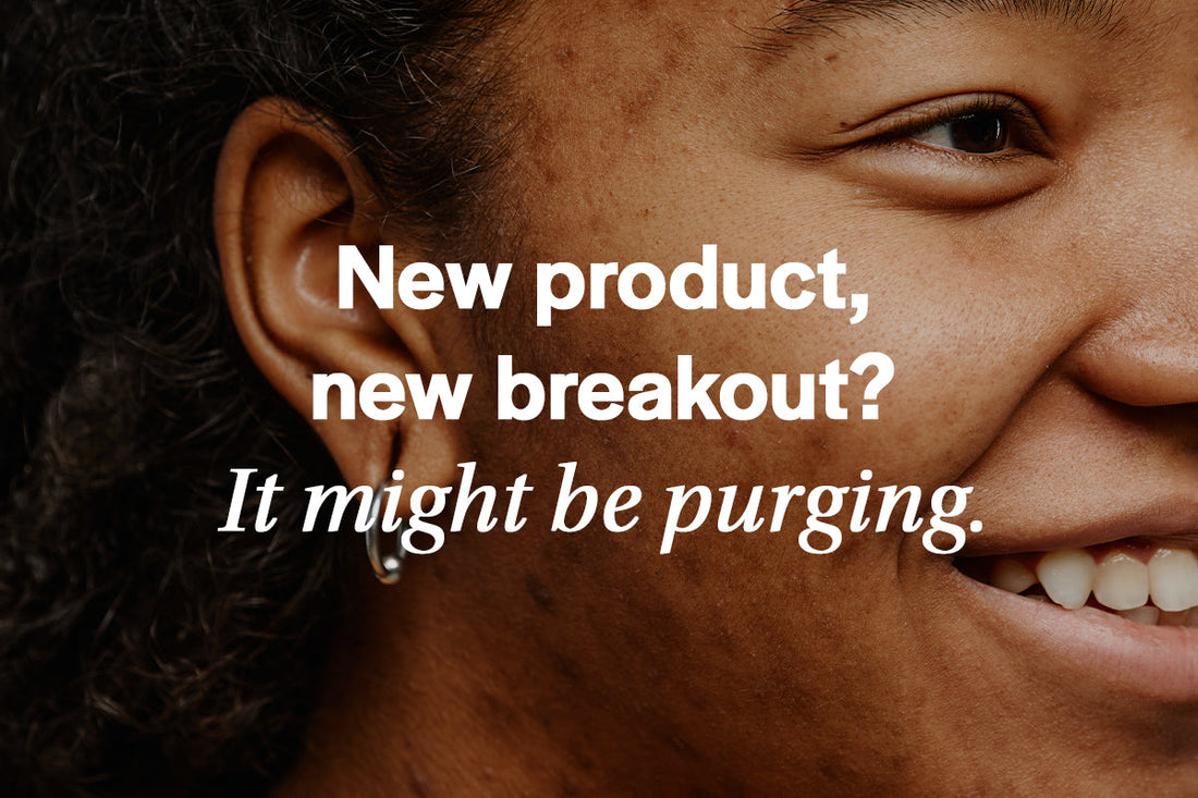 Skin Purging vs. Breakouts: How to Tell the Difference