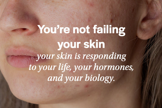 adult acne