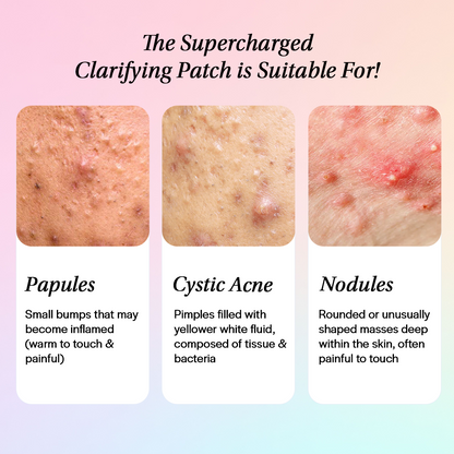 Supercharged Clarifying Spot Patch