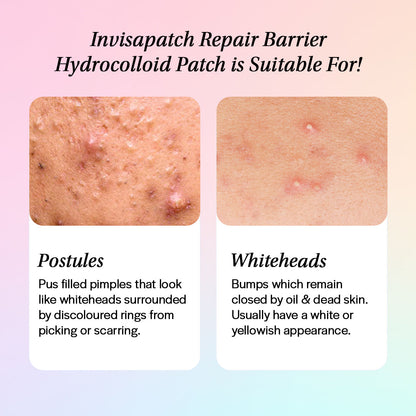Invisapatch before and after